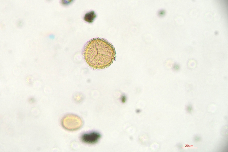 显微镜下放大40倍的石松孢子